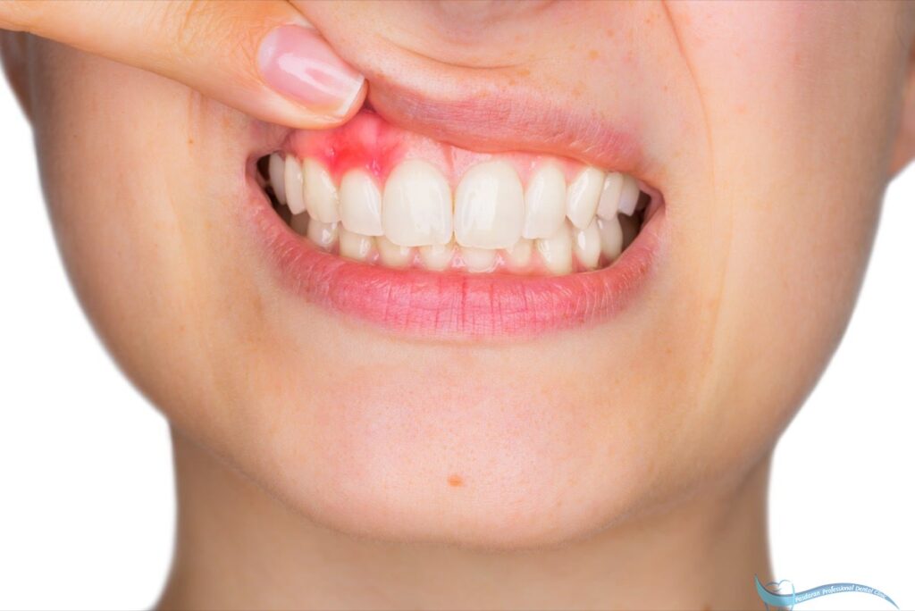 عوارض عفونت دندان که لازم است بدانید! 4 200 min