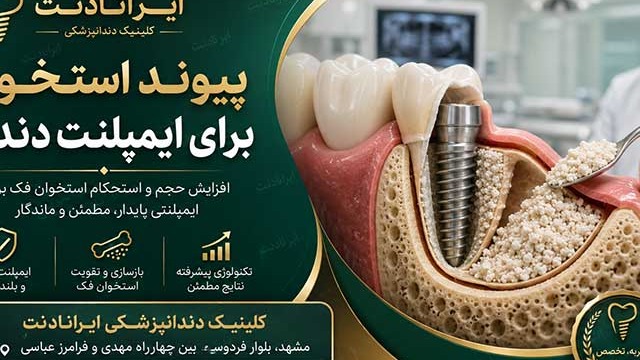 کمبود استخوان فک مانع ایمپلنت نیست | آشنایی با روش‌های بازسازی استخوان پیش از کاشت دندان