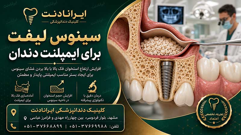 کمبود استخوان فک مانع ایمپلنت نیست؟! | آشنایی با روشهای بازسازی استخوان پیش از کاشت دندان 1 سینوس لیفت چیست و چه ارتباطی با ایمپلنت دارد؟