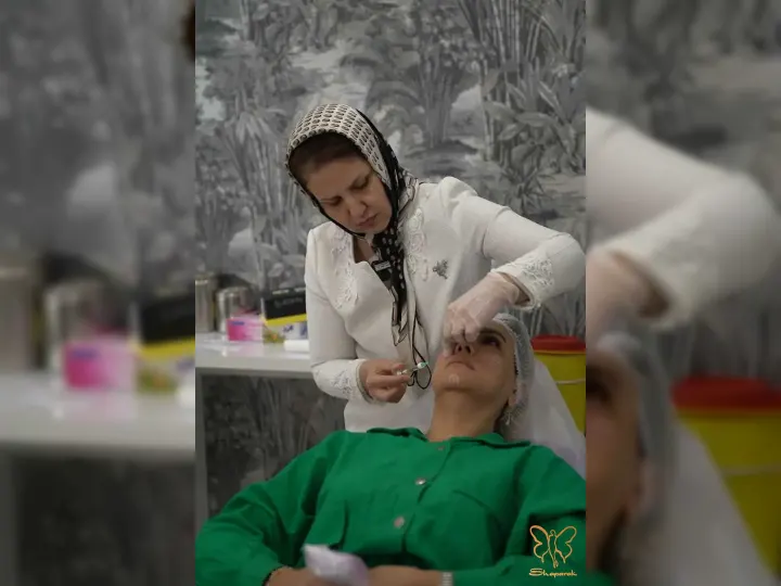 لیفت صورت در کلینیک شاپرک مشهد